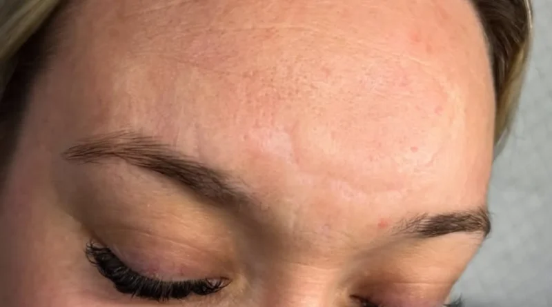 Cosmetic Tattoo Courses Melbourne