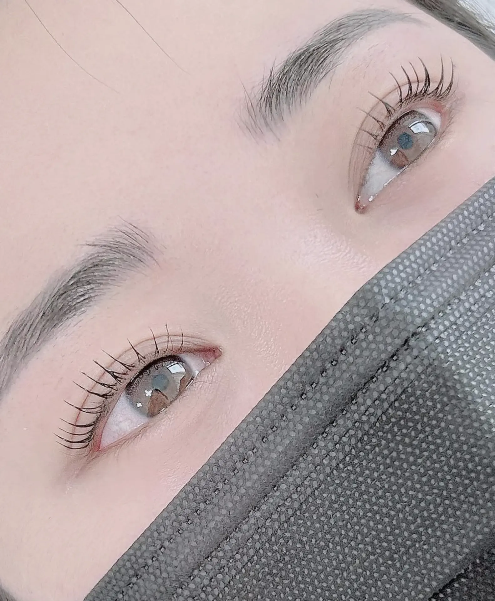 Combination brows for patchy eyebrow hair loss
