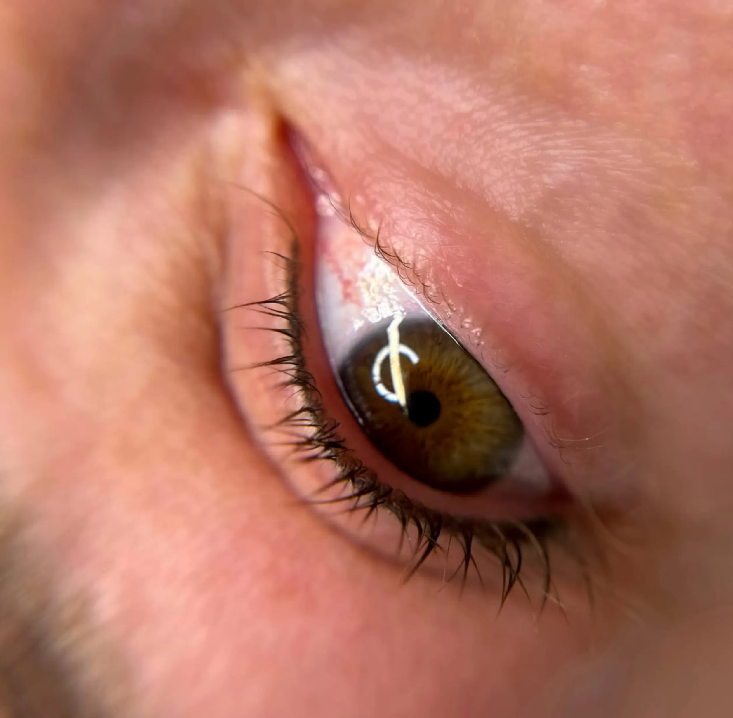 swollen eyelids after tattoo