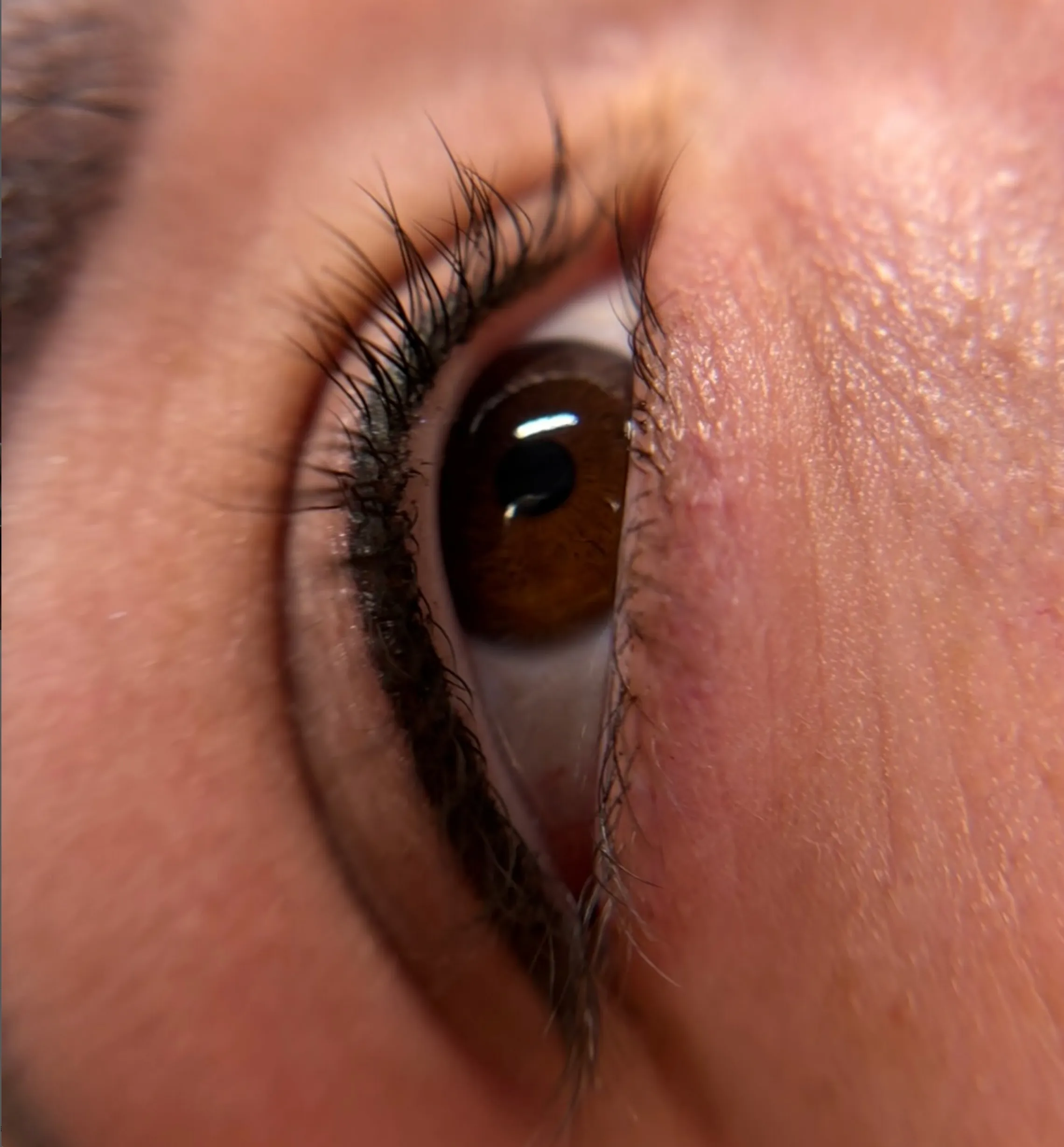 reduce swelling eyeliner tattoo