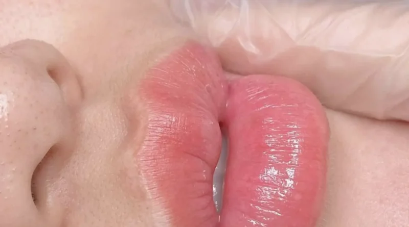 What are the stages of lip blushing?